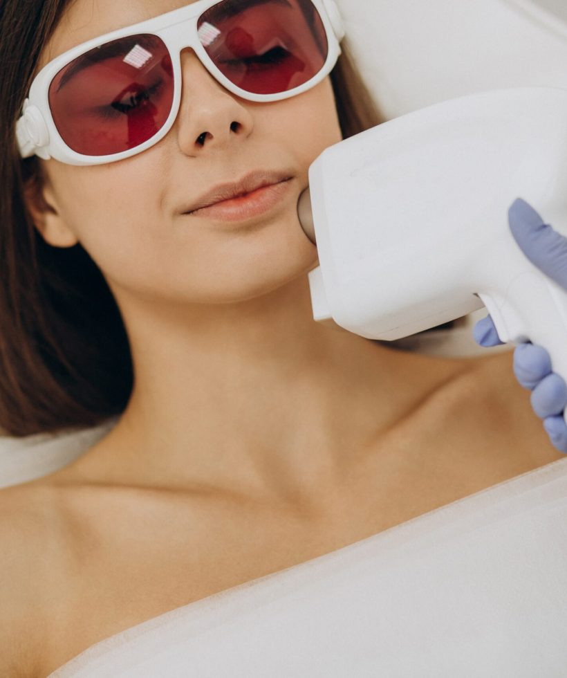 laser-epilation-hair